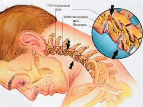 Форма суставных поверхностей непарного атлантоосевого сустава ответ. Атлантоосевые сочленения