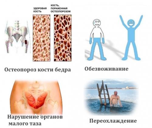 Судороги в бедренных мышцах причины. Почему возникает мышечный спазм бедра и как его снять?