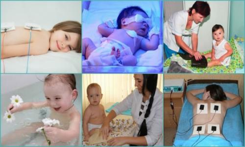 Дисплазия тазобедренных суставов у взрослых лечение. Лечение патологии