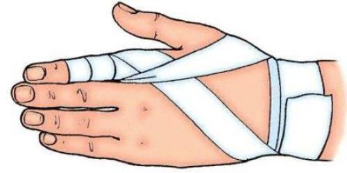 Как забинтовать палец на руке. Повязки при повреждении пальцев рук и ног