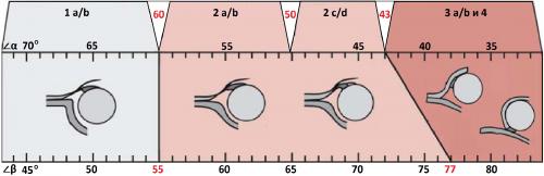 УЗИ тазобедренного сустава методика. УЗИ тазобедренных суставов у младенцев