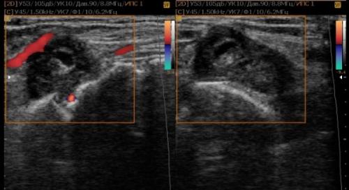 УЗИ голеностопного сустава. Что покажет УЗИ голеностопного сустава, как его проводят и когда назначают