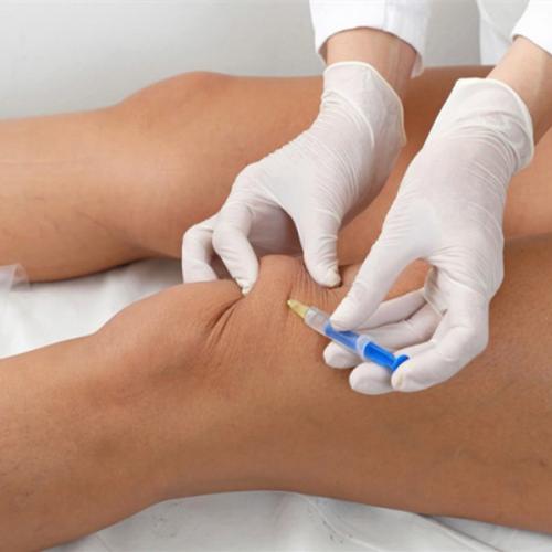 Жидкий протез для тазобедренного сустава. Эндопротезирование суставов. Новые технологии 02 Жидкий протез для тазобедренного сустава. Эндопротезирование суставов. Новые технологии 02