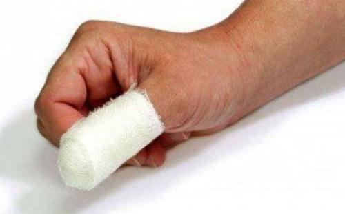 Как забинтовать палец на руке. Повязки при повреждении пальцев рук и ног