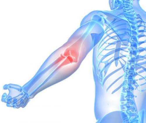 Хондропротекторы белорусского производства. Какие препараты относятся к хондропротекторам? 11