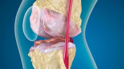 Хондропротекторы белорусского производства. Какие препараты относятся к хондропротекторам? 08 Хондропротекторы белорусского производства. Какие препараты относятся к хондропротекторам? 08