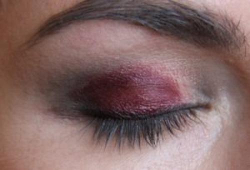 Внезапный синяк на веке. Появился синяк на верхнем веке без причины