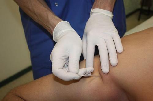 Хрустят суставы в плечах, что делать. Виды патологии 06