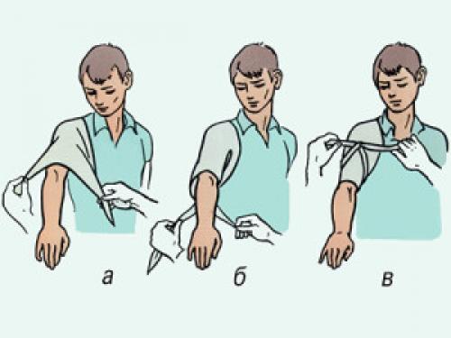 Фиксирующая повязка на плечо. Повязка на плечевой сустав