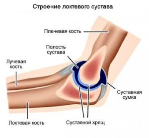 Болит локоть чем мазать. Мазь при боли в локтевом суставе