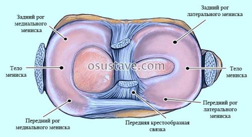 Надрыв мениска коленного сустава, что это такое. Виды повреждений мениска коленного сустава: их обзор, степени, симптомы и лечение