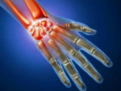 Комбинированные суставы примеры. Классификация и общая характеристика 04 Комбинированные суставы примеры. Классификация и общая характеристика 04