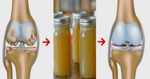 Как восстановить хрящевую ткань тазобедренного сустава. Народная медицина