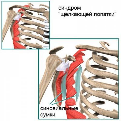 Хрустит ключица при вращении плечом. От чего появляется? 03 Хрустит ключица при вращении плечом. От чего появляется? 03