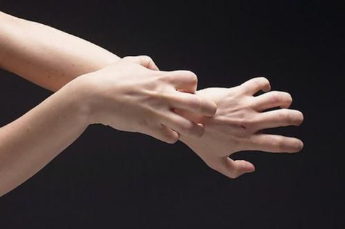 Опухли косточки на пальцах рук и чешутся. Опухли пальцы на руках и чешутся: причины