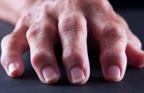 Шишка на пальце руки болит. Какие виды встречаются