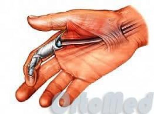 Анатомия фаланги пальцев рук. Особенности строения 05 Анатомия фаланги пальцев рук. Особенности строения 05