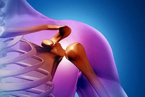 Реабилитация после перелома большого бугорка плечевой кости. Перелом большого бугорка плечевой кости