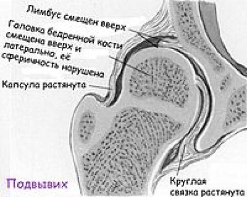 Связки тазобедренного сустава фото