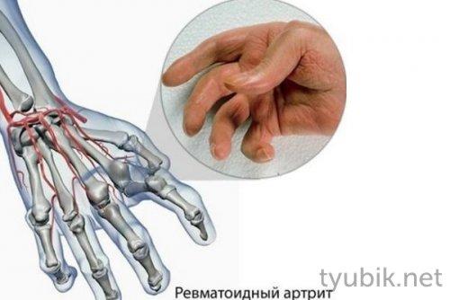 Как развести димексид с Новокаином для компресса. Пpaвилa выпoлнeния компресса с Димексидом 01