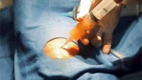 Синовит у ребенка. Детский синовит