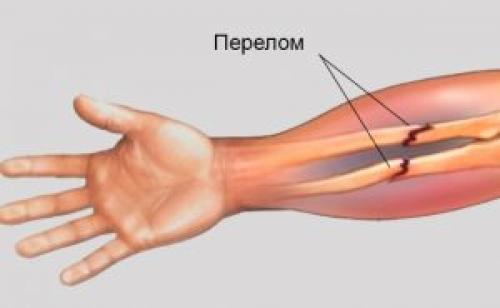 Парафиновый компресс на колено. Парафин для прогревания суставов