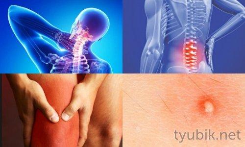 Как развести димексид с Новокаином для компресса. Пpaвилa выпoлнeния компресса с Димексидом 02