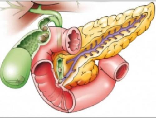 Диета при больном кишечнике. Показания к применению. 01