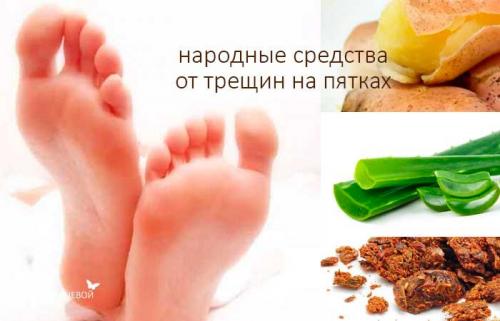 Помогает ли Касторовое масло при лечении трещин на пятках. Лечение трещин на пятках