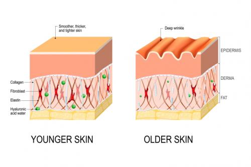 Как сделать кожу упругой и подтянутой. Почему кожа теряет упругость