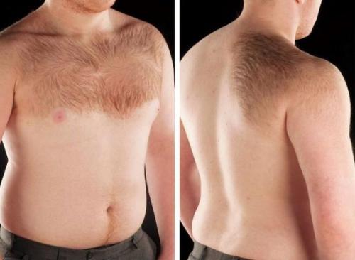 Как избавиться от пигментных пятен на лице. Пигментное пятно —, что это такое 03 Как избавиться от пигментных пятен на лице. Пигментное пятно —, что это такое 03