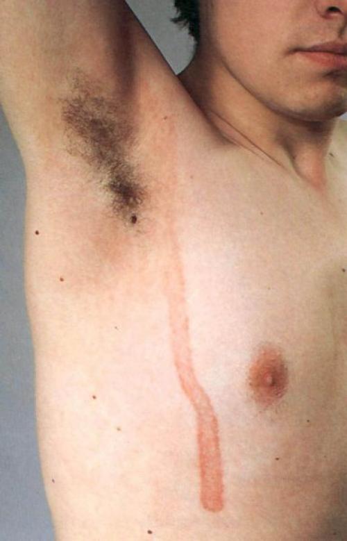 Как избавиться от пигментных пятен на лице. Пигментное пятно —, что это такое 05 Как избавиться от пигментных пятен на лице. Пигментное пятно —, что это такое 05