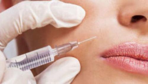 Как избавиться от носогубных складок косметология. 5 способов, как убрать носогубные складки