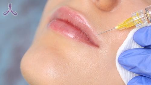 Как убрать кисетные морщины. Как избавиться от кисетных морщин? 03