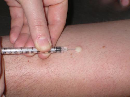 Диета после мант: какие продукты нельзя есть 01