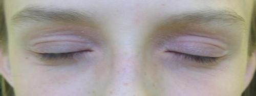 Как ухаживать за кожей век. Почему коже вокруг глаз требуется особый уход 09