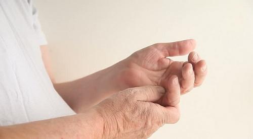 Физиотерапия при лечении артрита. Лечение артрита кистей 01 Физиотерапия при лечении артрита. Лечение артрита кистей 01