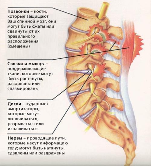 Хондропротекторы для позвоночника уколы. Какие уколы могут назначать при остеохондрозе?