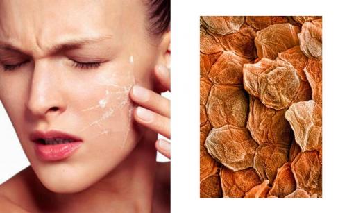 Как выбрать правильное масло для борьбы с морщинами 01 Как выбрать правильное масло для борьбы с морщинами 01