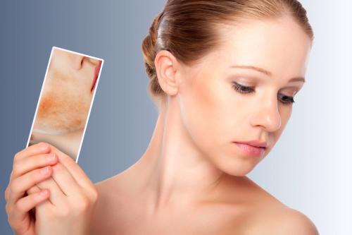 Какие народные методы можно использовать для лечения черного пятна под кожей. Можно ли избавиться от пигментных пятен в домашних условиях