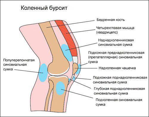 Колени горячие причины. Отёк колена: причины и лечение 05