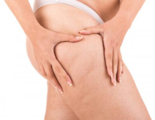 Массаж скалкой для похудения. Как избавиться от целлюлита на бедрах и ягодицах