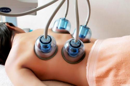 Как самостоятельно делать баночный массаж от целлюлита. Как делать вакуумный массаж тела в домашних условиях? 04