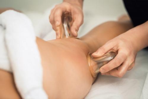 Баночный массаж для похудения. Как ставить банки: главные правила