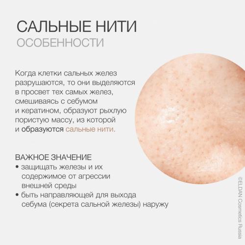 Что такое сальные нити на лице и как с ними бороться 02 Что такое сальные нити на лице и как с ними бороться 02