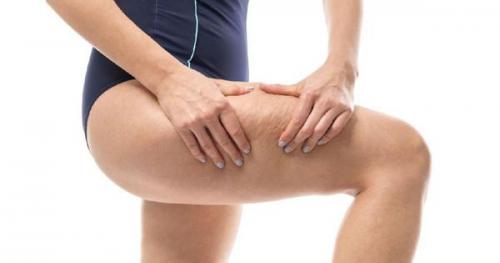 4 ошибки в борьбе с целлюлитом. Главные ошибки при борьбе с целлюлитом 01 4 ошибки в борьбе с целлюлитом. Главные ошибки при борьбе с целлюлитом 01