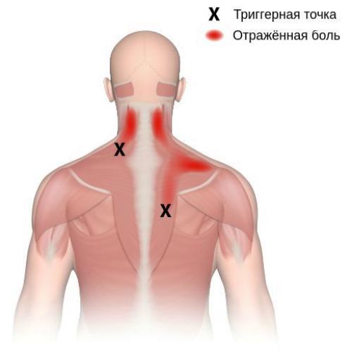 Тренажерный зал в борьбе за стройные женские ноги. Какие упражнения обязательны в день ног 07 Тренажерный зал в борьбе за стройные женские ноги. Какие упражнения обязательны в день ног 07