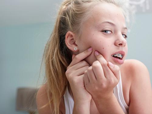 Как убрать черные точки на носу у ребенка в домашних условиях. Избавляем тинейджера от черных точек с применением натуральных средств