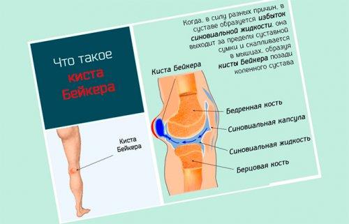 Горячие колени причины. Ноют колени 02 Горячие колени причины. Ноют колени 02
