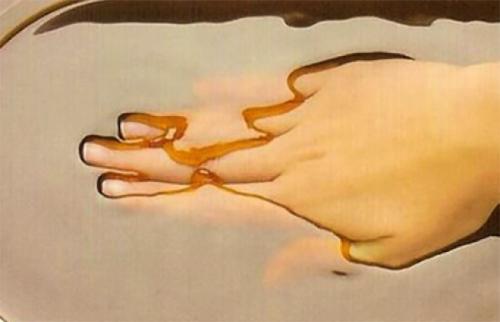 Парафиновый компресс на колено. Парафин для лечения суставов: полезные свойства и применение